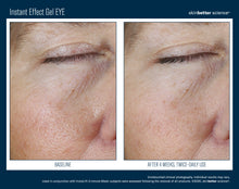 Load image into Gallery viewer, skinbetter Instant Effect Gel
