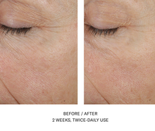 Load image into Gallery viewer, skinbetter Even Tone Correcting SErum
