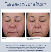 Load image into Gallery viewer, skinbetter Mystro Activ Balance Serum
